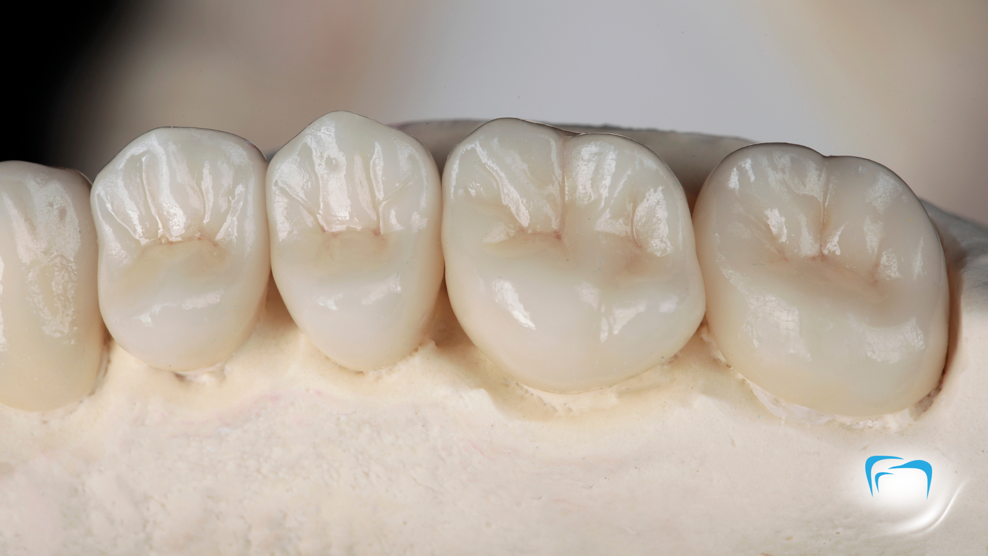 A close up of a model of a person 's teeth.