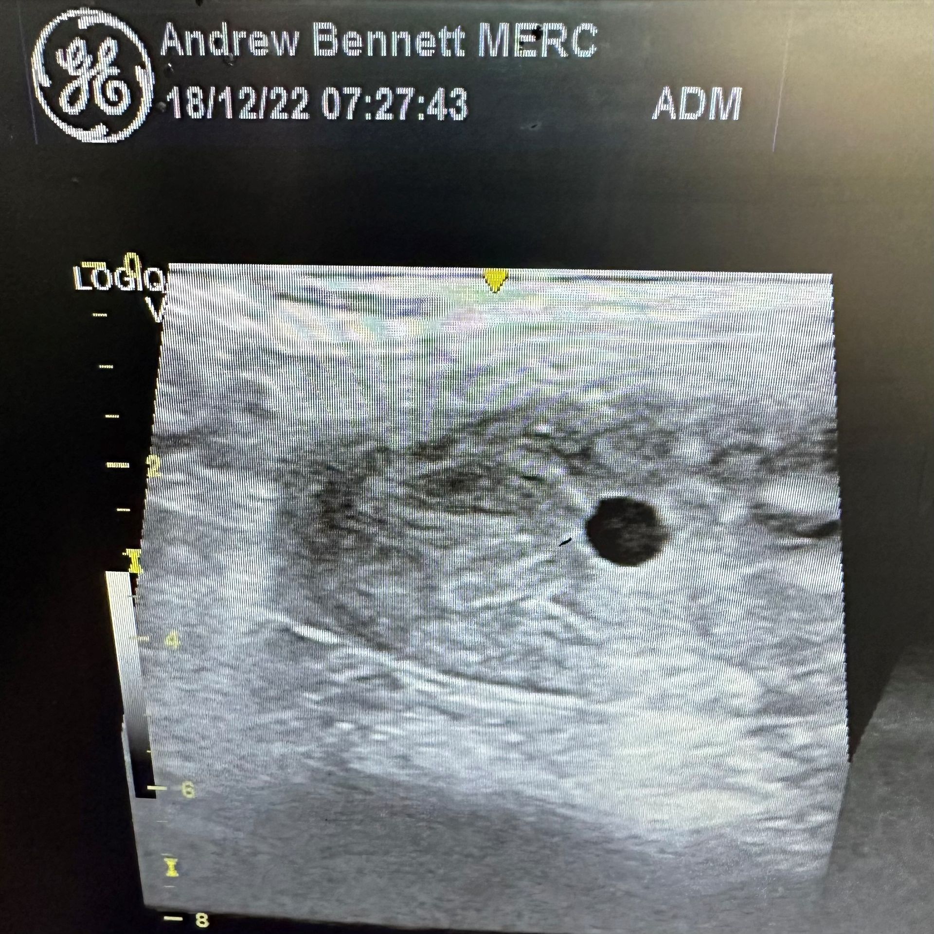 View in the Micro Scope — Horse Embryo Transfer Kempsey, NSW