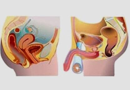 DR. ARTURO DANIEL JUÁREZ HERNÁNDEZ - ENFERMEDADES DE LAS VÍAS URINARIAS