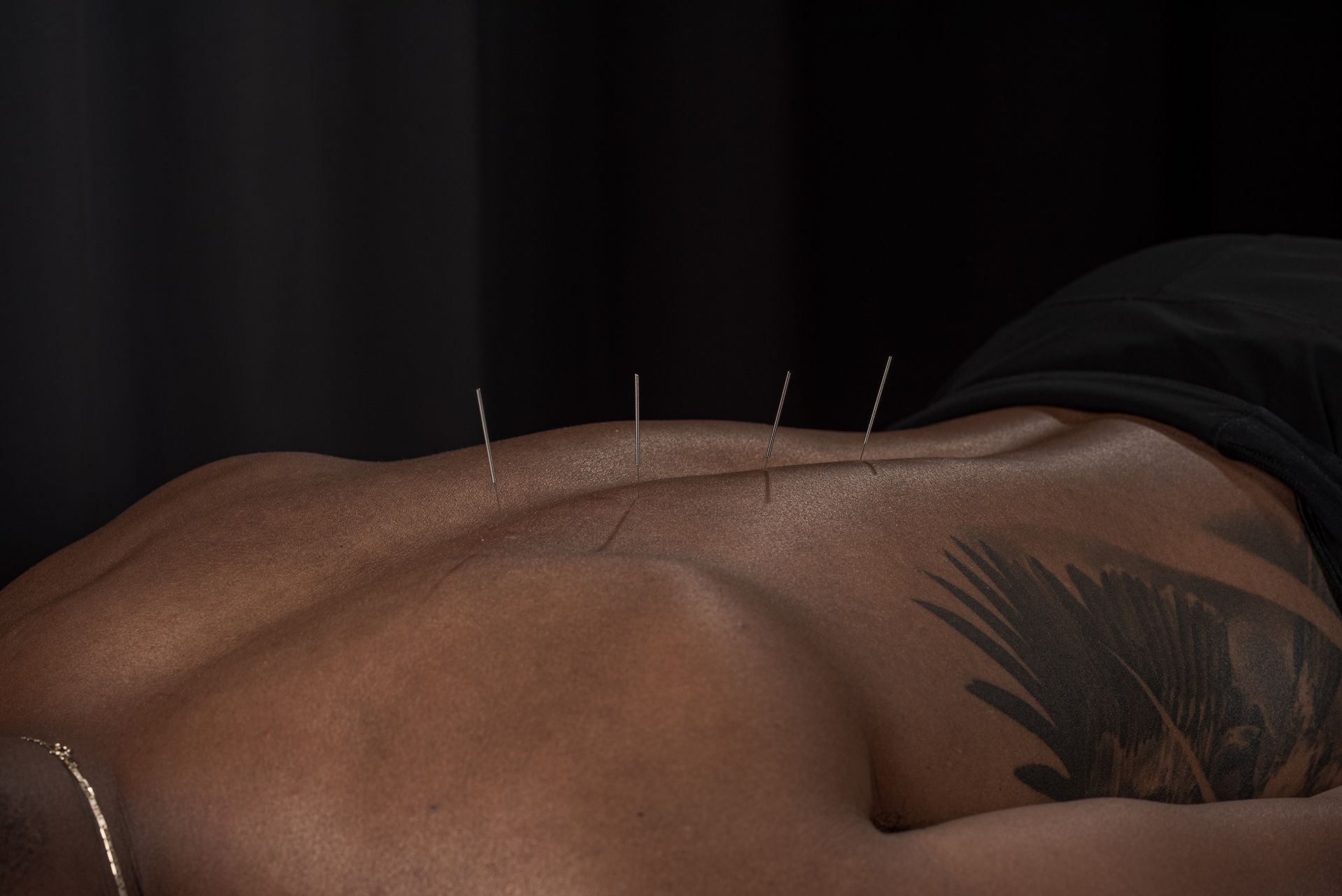 physical rehabilitation 