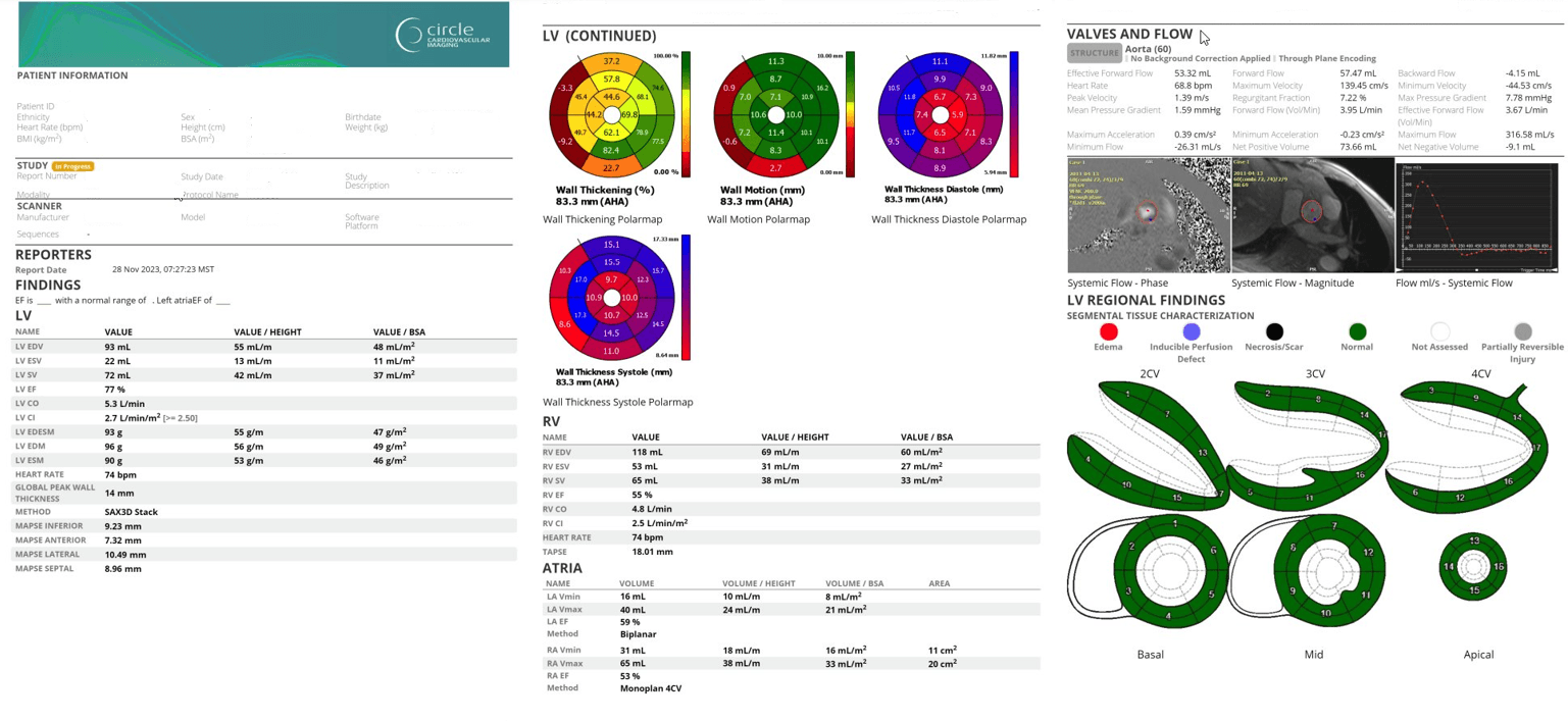 Eye exam results with corneal topography maps and cross-sectional images.