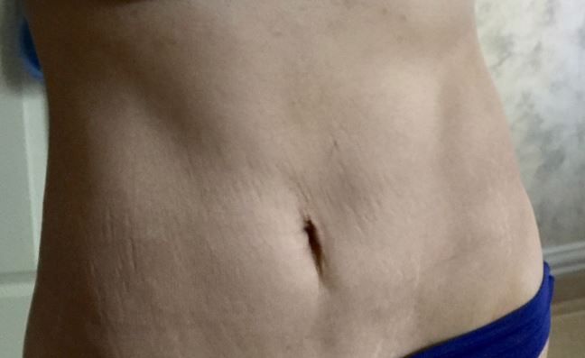 A close up of a woman 's stomach and belly in blue underwear.