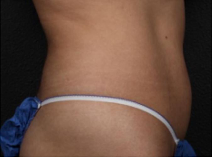 A woman 's torso is shown in a blue and white thong.