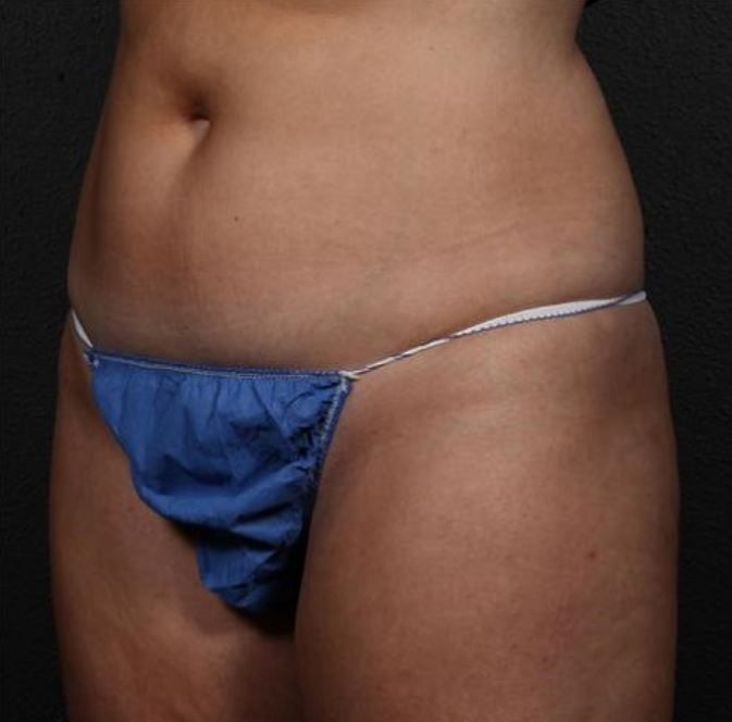 A woman is wearing a pair of blue thongs.