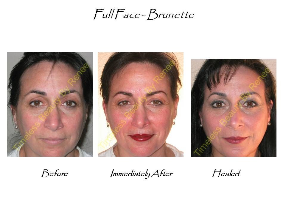 A before and after photo of a woman 's face with the caption full face brunette
