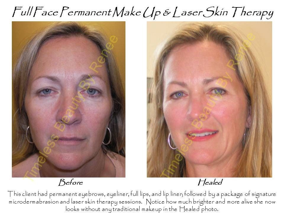 A woman 's face before and after a full face permanent make up and laser skin therapy