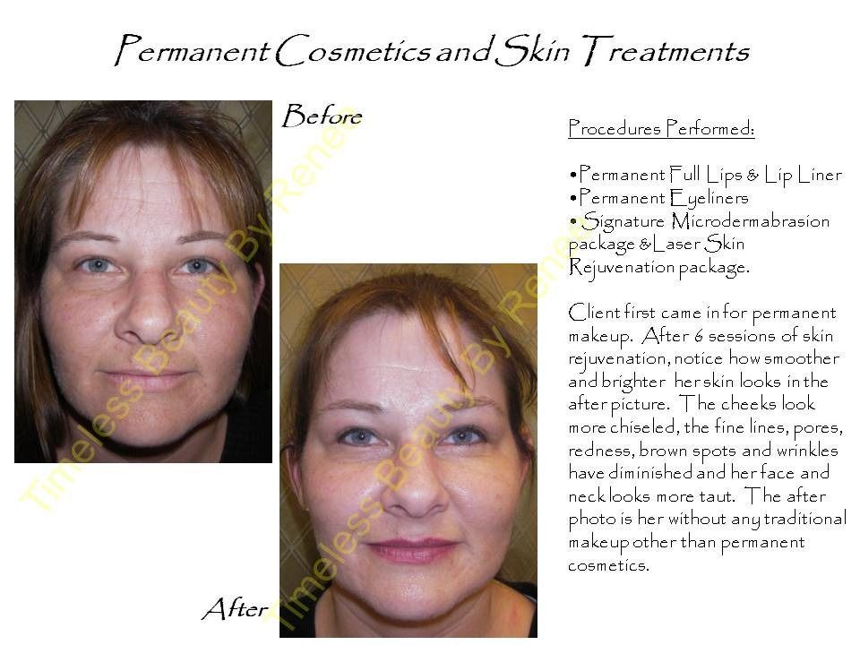 A woman 's face before and after permanent cosmetics and skin treatments