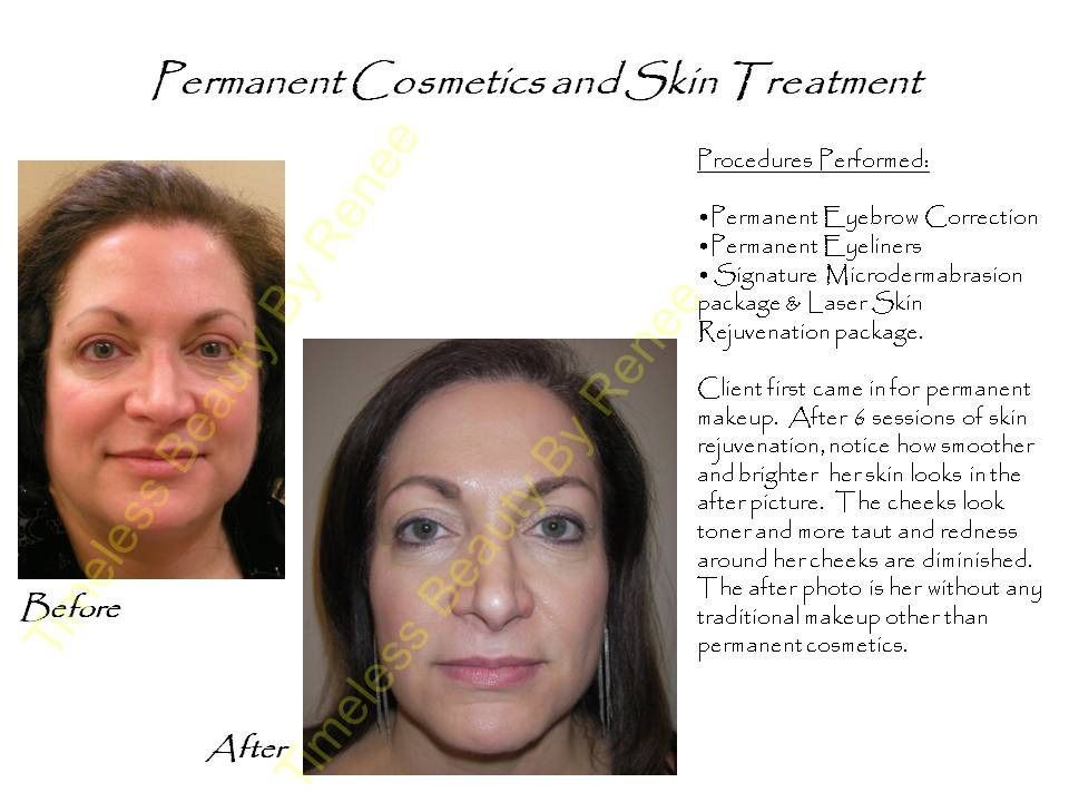 A woman 's face before and after permanent cosmetics and skin treatment