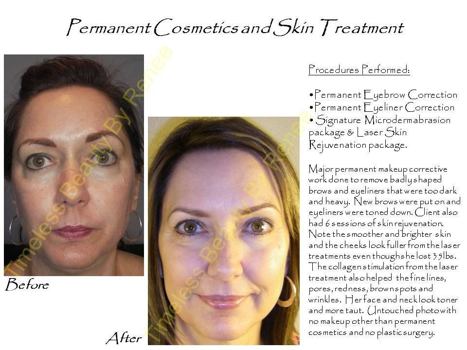 A woman 's face before and after permanent cosmetics and skin treatment