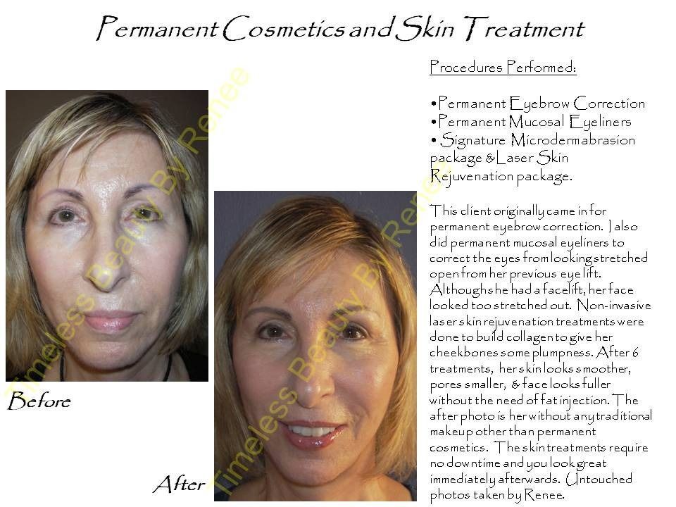 A picture of a woman before and after permanent cosmetics and skin treatment.