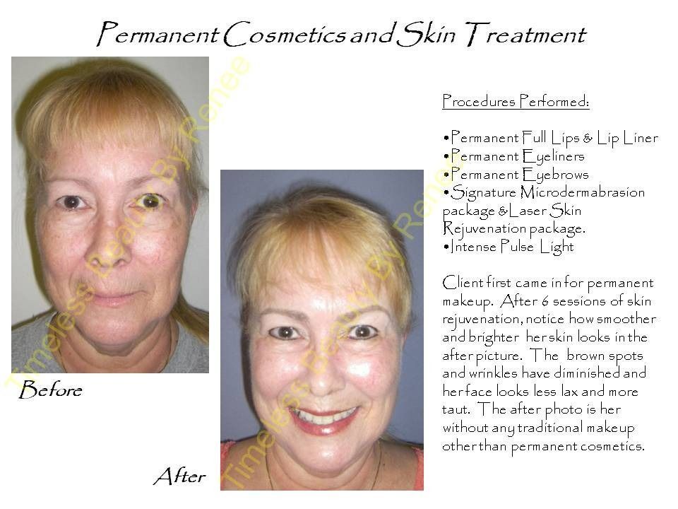 A picture of a woman before and after permanent cosmetics and skin treatment