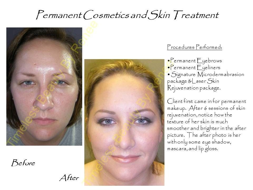 A picture of a woman before and after permanent cosmetics and skin treatment