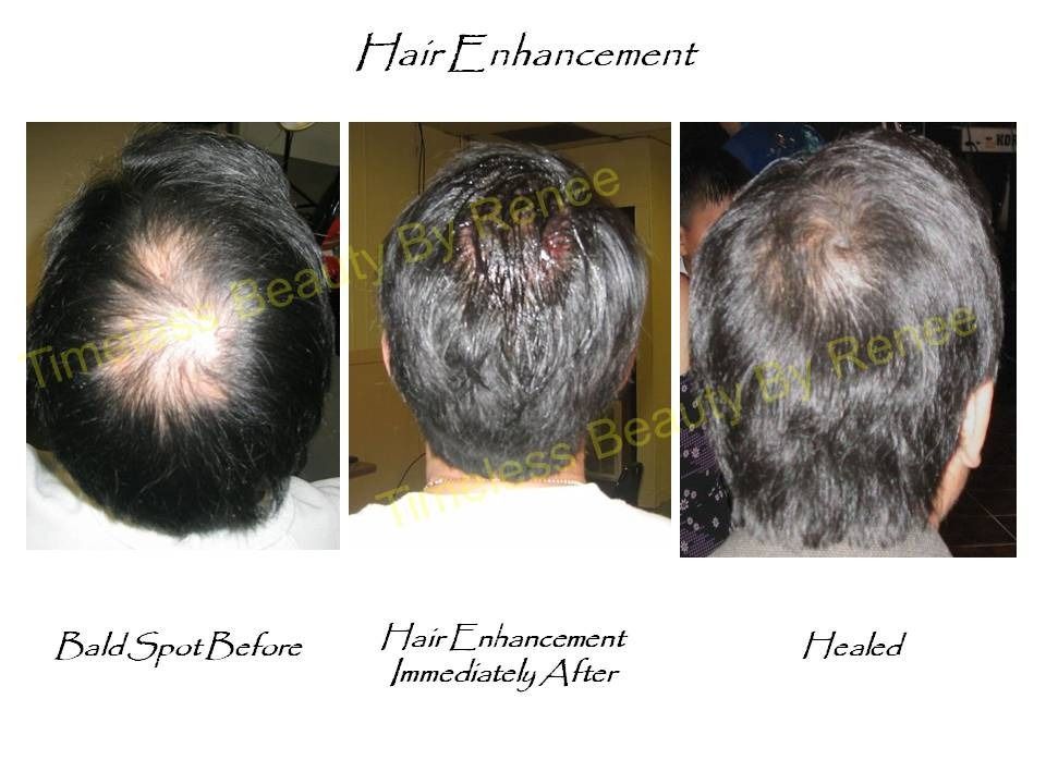 Three pictures of a man 's hair before and after hair enhancement