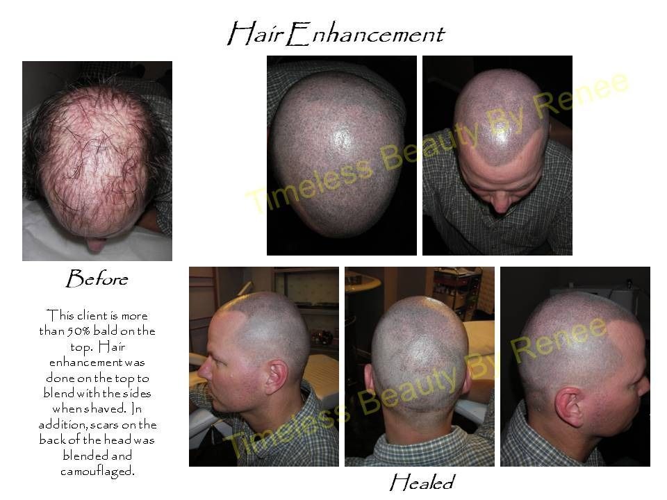 A picture of a man 's head before and after hair enhancement