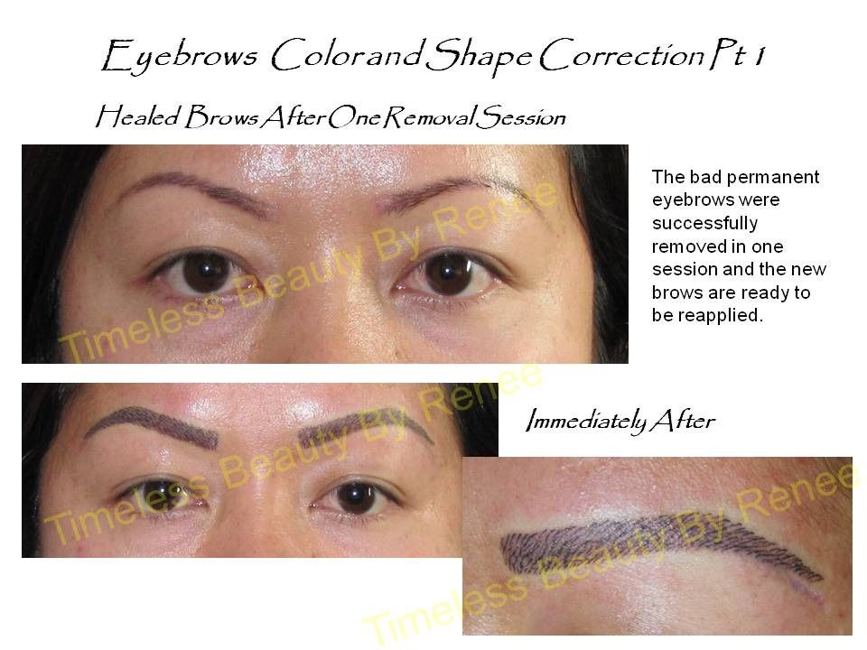 A before and after picture of a woman 's eyebrows