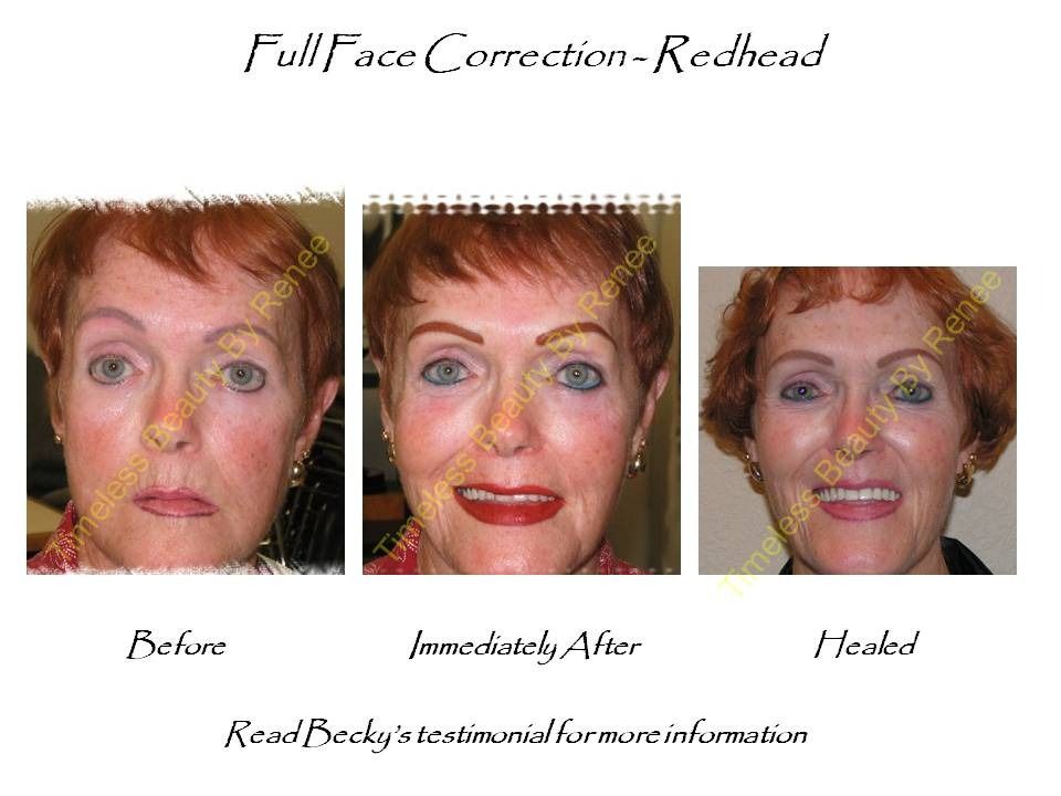 A before and after photo of a woman with red hair