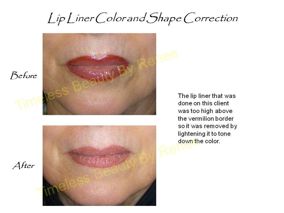 A picture of a woman 's lips before and after lip liner color and shape correction