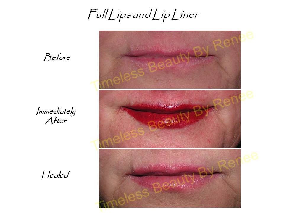 A before and after photo of a woman 's lips and lip liner