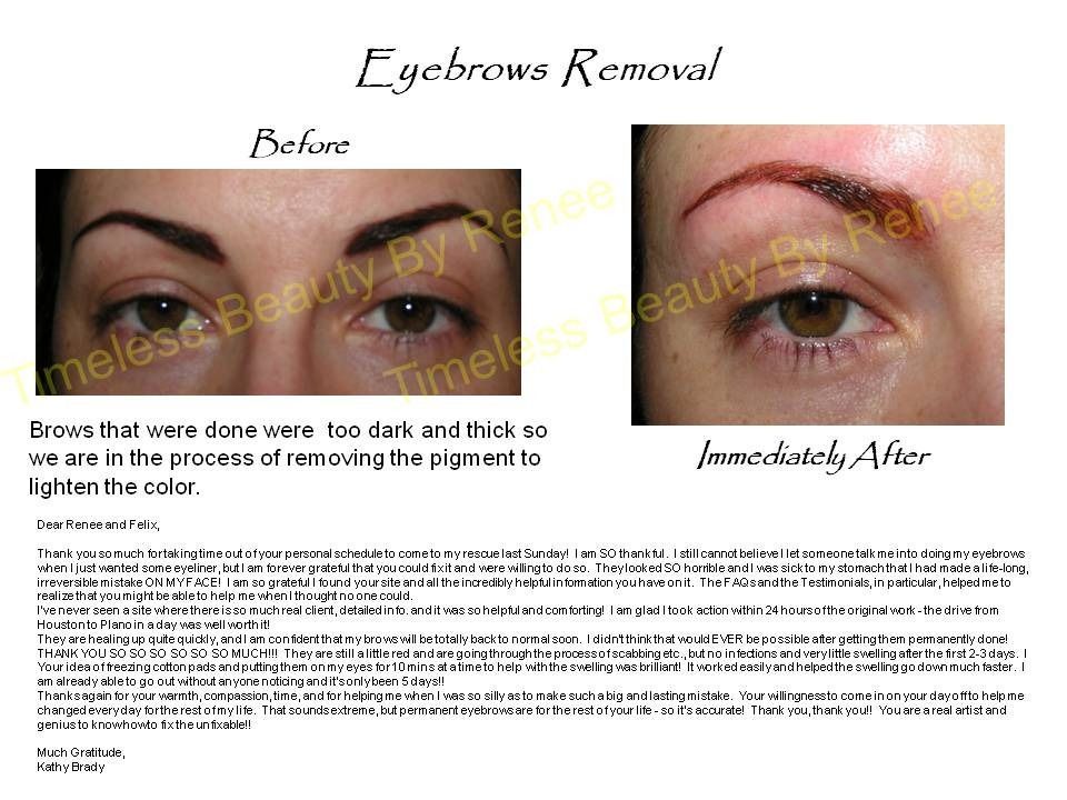 A before and after picture of a woman 's eyebrows