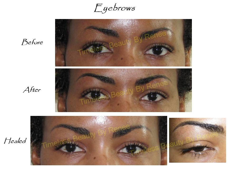 A before and after photo of a woman 's eyebrows