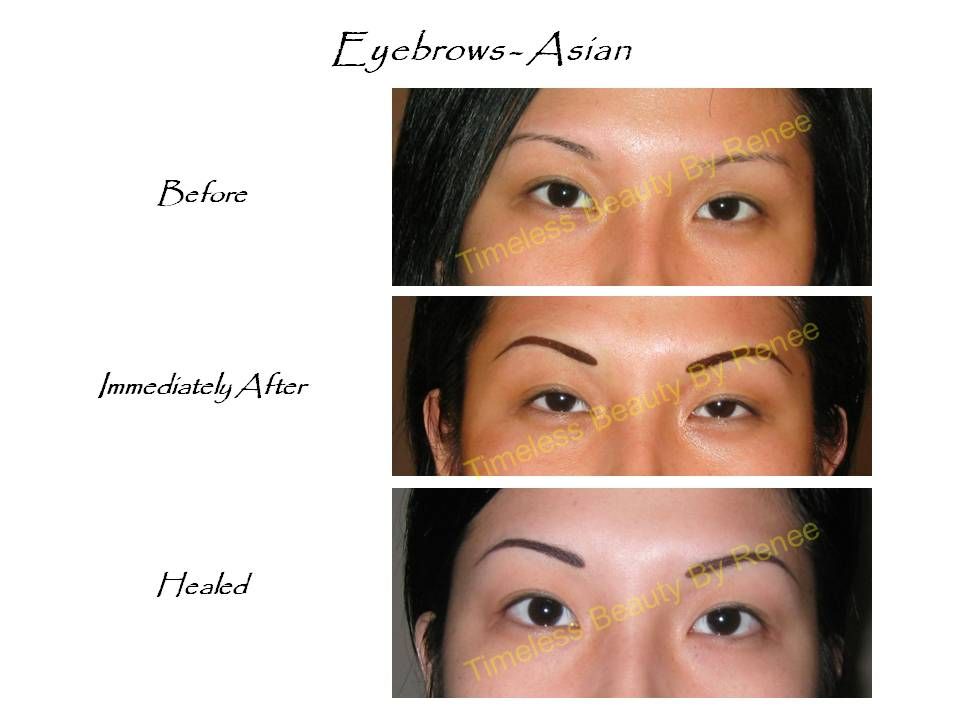 A before and after picture of asian eyebrows