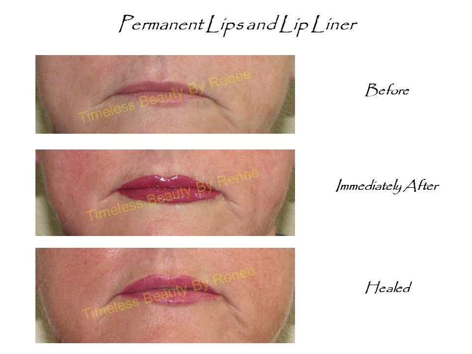 A before and after picture of permanent lips and lip liner