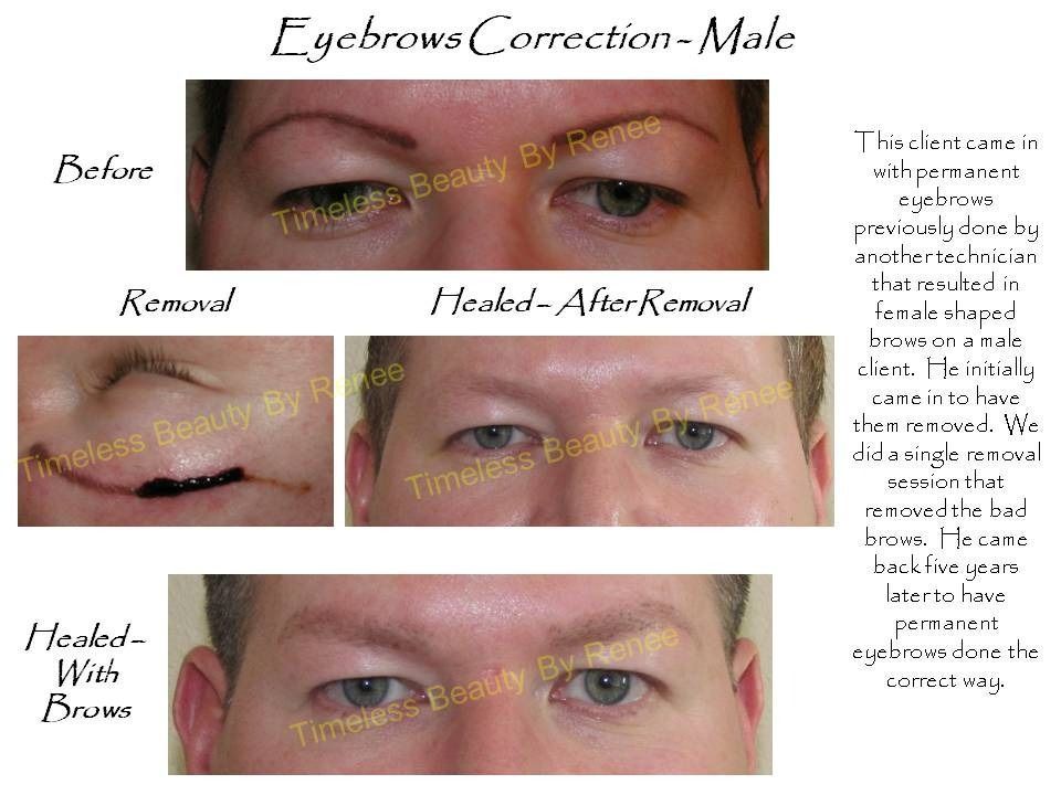 A before and after picture of a man 's eyebrows