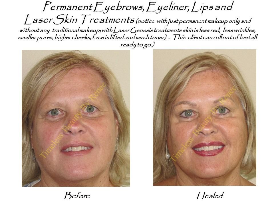 A before and after photo of a woman with permanent eyebrows , eyeliner , lips and laser skin treatments