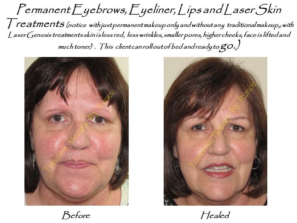 A picture of a woman before and after permanent eyebrows eyeliner lips and laser skin treatments