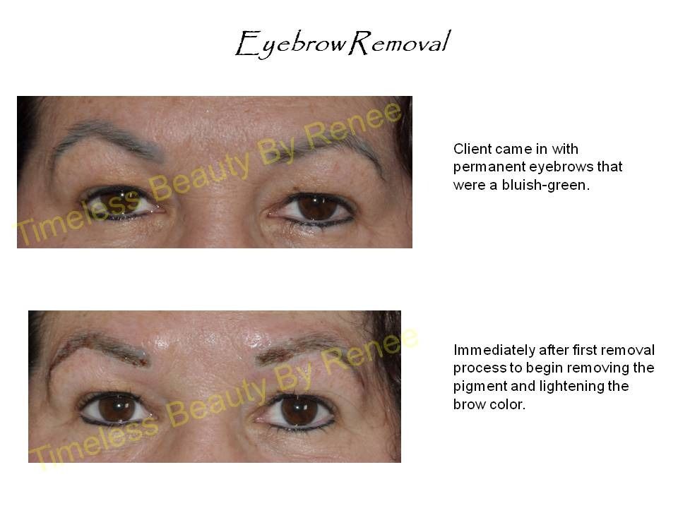 A picture of a woman 's eyebrows before and after eyebrow removal