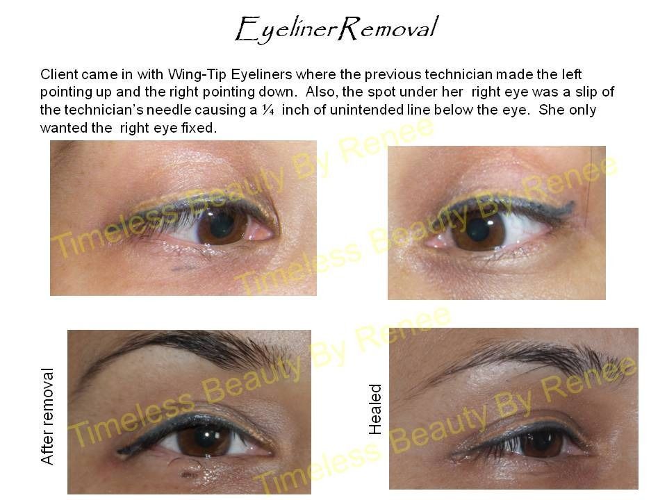 A picture of a woman 's eyes before and after eyeliner removal