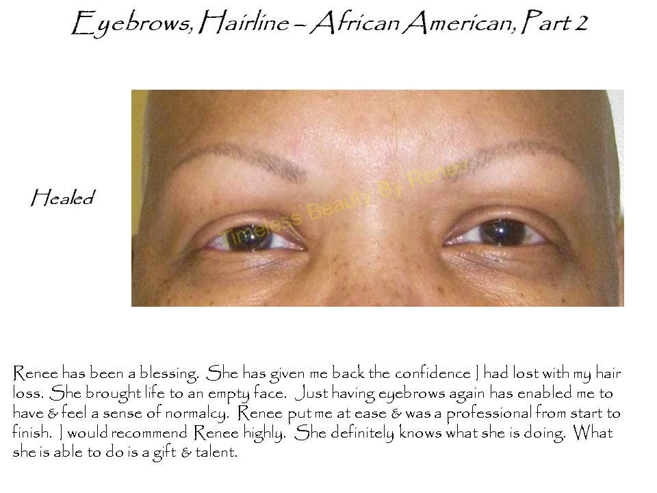 A picture of a woman 's eyebrows with the caption eyebrows hairline african american part 2
