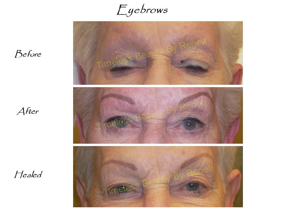 A before and after picture of a woman 's eyebrows