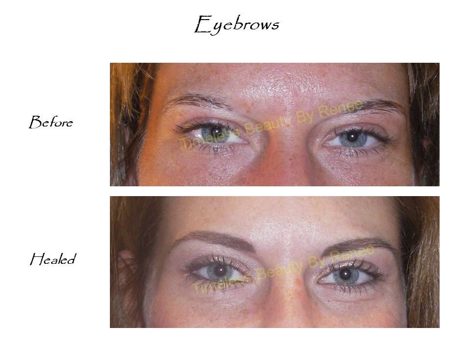 A before and after picture of a woman 's eyebrows