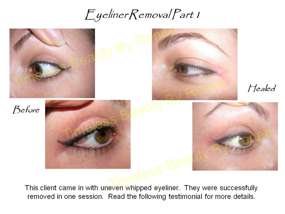 A picture of a woman 's eye before and after eyeliner removal