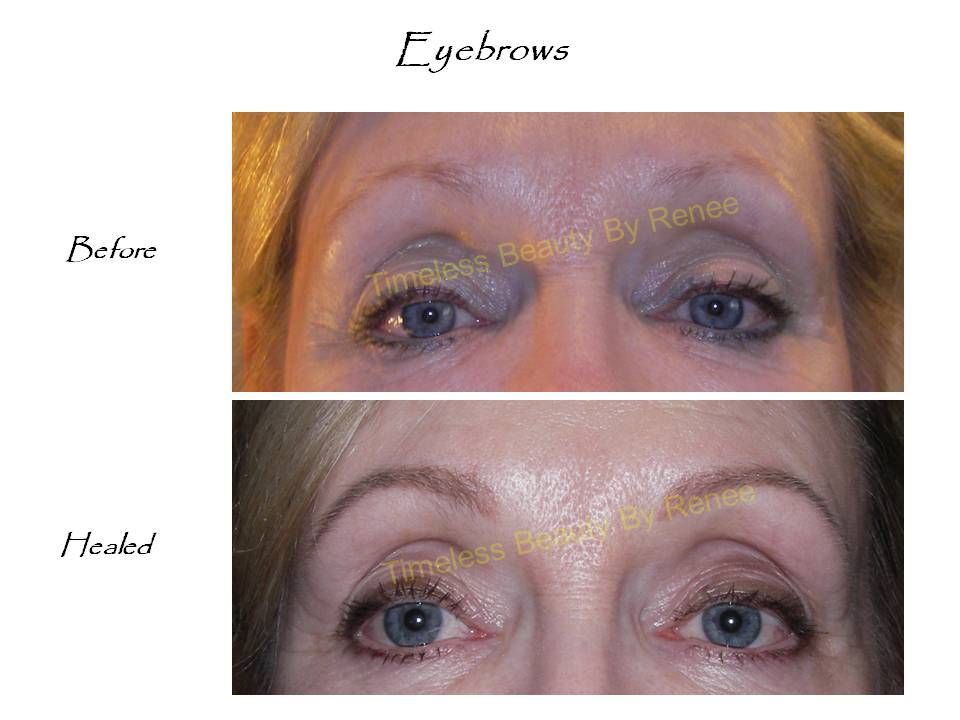 A before and after picture of a woman 's eyebrows
