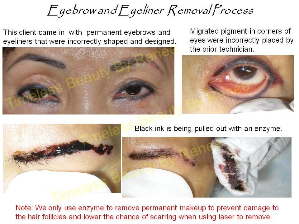 A picture of an eyebrow and eyeliner removal process