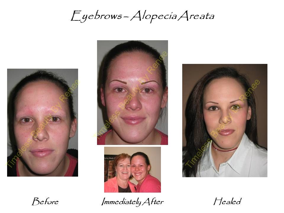 A before and after photo of a woman 's eyebrows