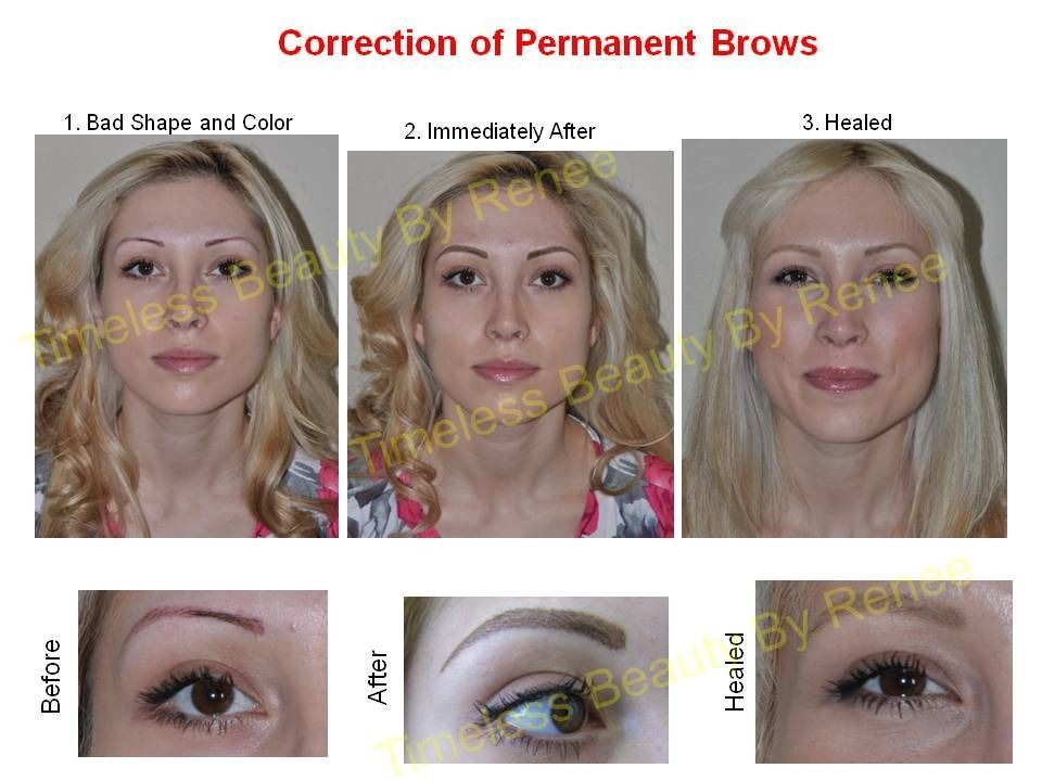 A before and after photo of a woman 's permanent eyebrows