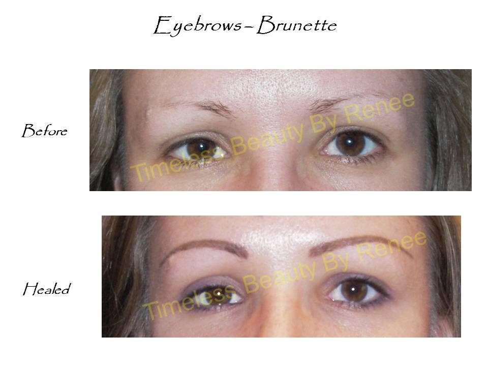 A before and after picture of a woman 's eyebrows