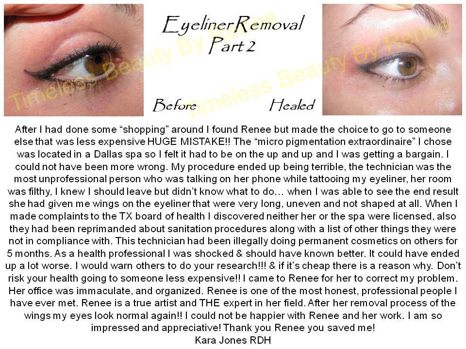 A before and after picture of eyeliner removal part 2