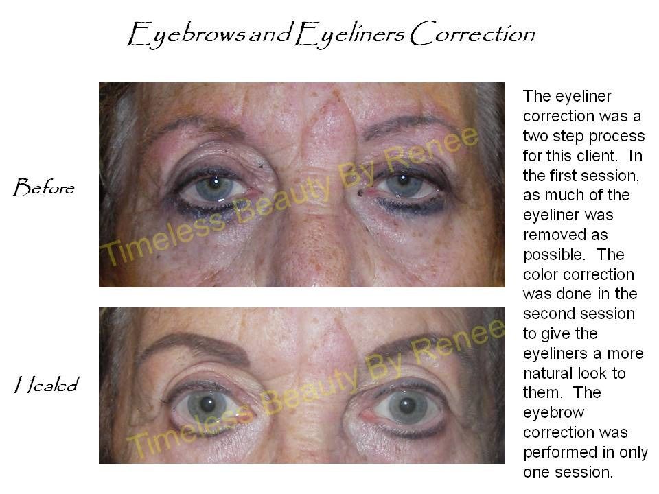 A before and after picture of a woman 's eyebrows and eyeliners correction
