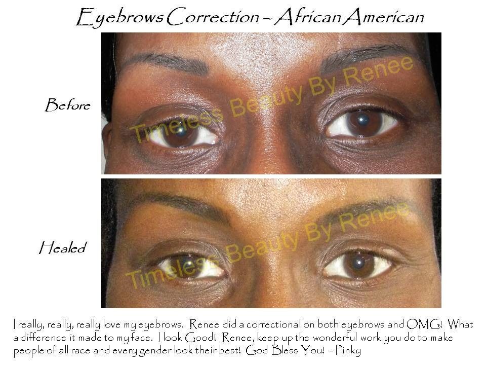 A before and after photo of a woman 's eyebrows by renee