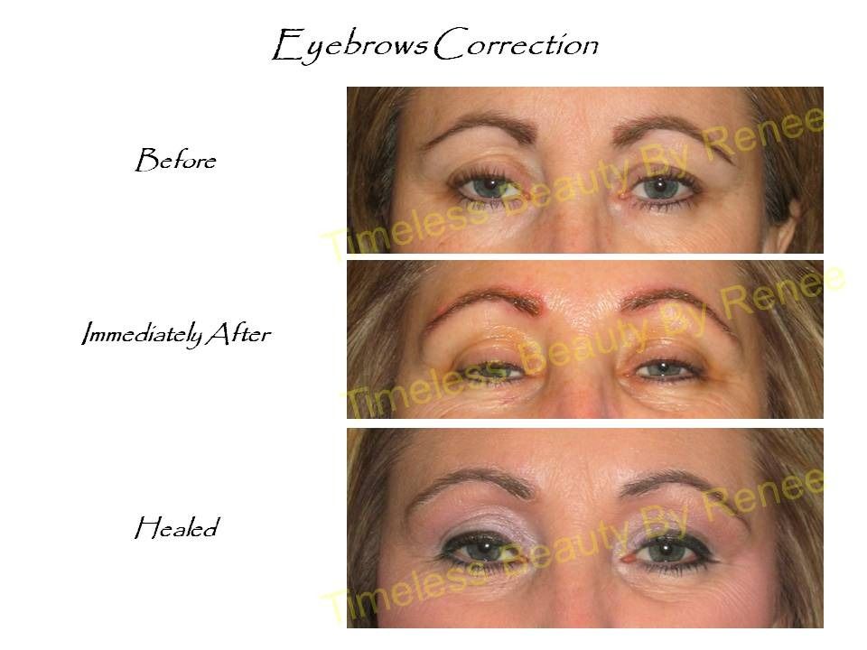 A before and after photo of a woman 's eyebrows