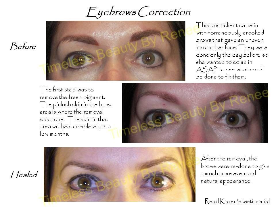 A before and after picture of a woman 's eyebrows