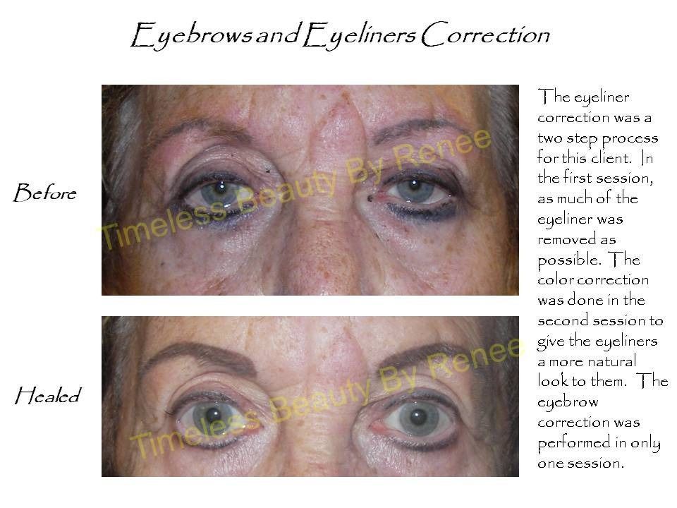 A before and after picture of a woman 's eyebrows and eyeliners correction