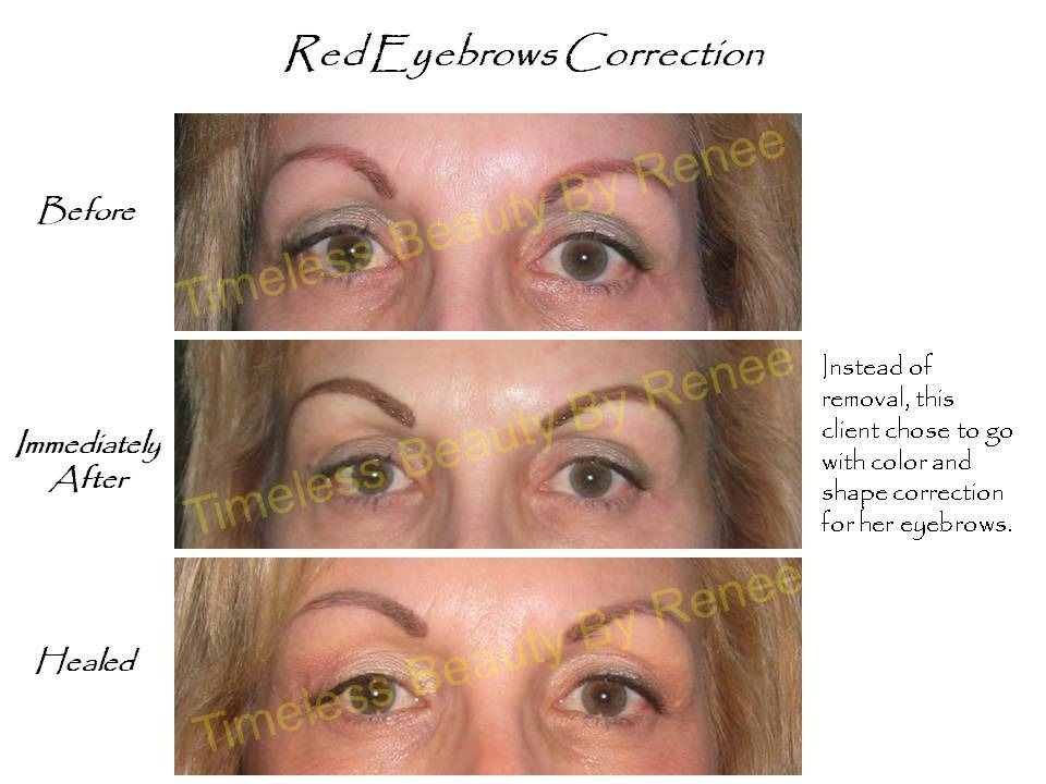A before and after photo of a woman 's eyebrows