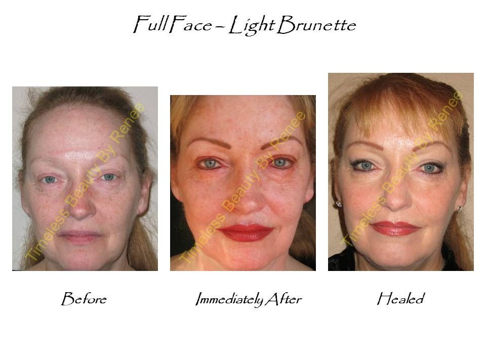 Three pictures of a woman 's face with the caption full face light brunette