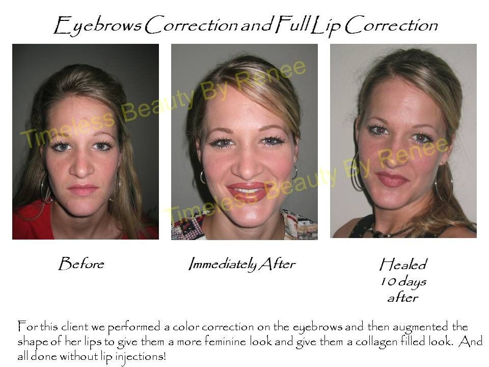 Three pictures of a woman before and after eyebrows correction and full lip correction