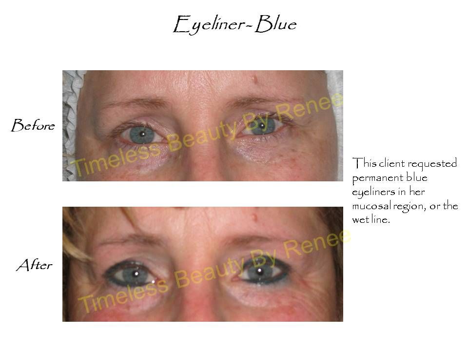 A before and after picture of a woman 's eyes with eyeliner blue